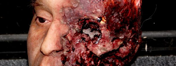 Silicone Head Casualty