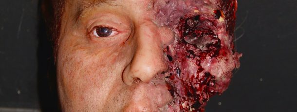 Silicone Head Casualty