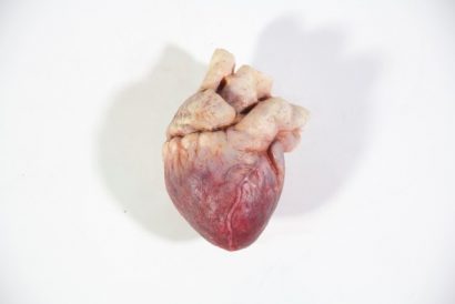 Heart 1