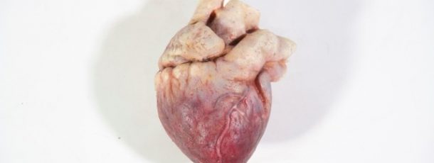 Heart 1