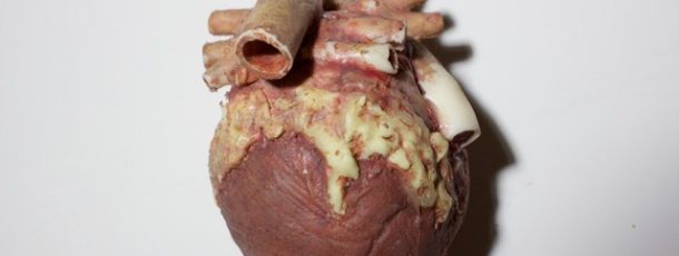 Animatronic Heart