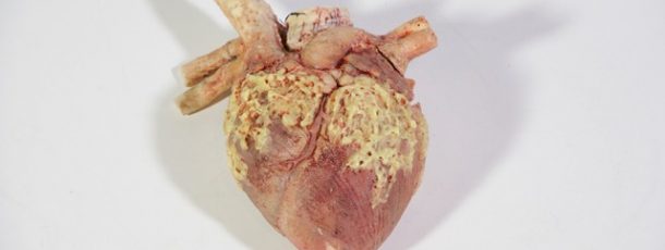 Heart 2