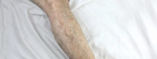 Female Leg